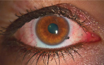 Косметические средства — как они влияют на поверхность глаз? 1