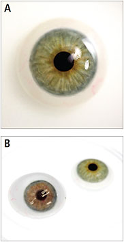 Контактные линзы для эстетического протезирования глаз 5