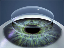 Новые контактные линзы со стволовыми клетками смогут восстанавливать зрение