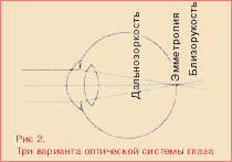 Что такое рефракция? 1