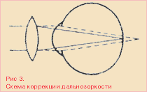 Что такое рефракция? 2