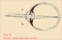 Что такое рефракция? 4