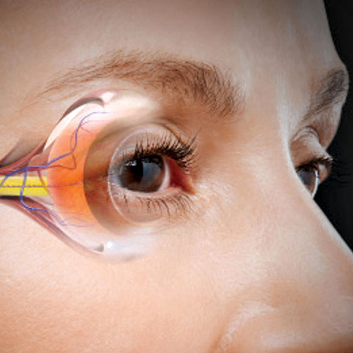 Глаукома – медленный убийца зрения, с которым можно справиться